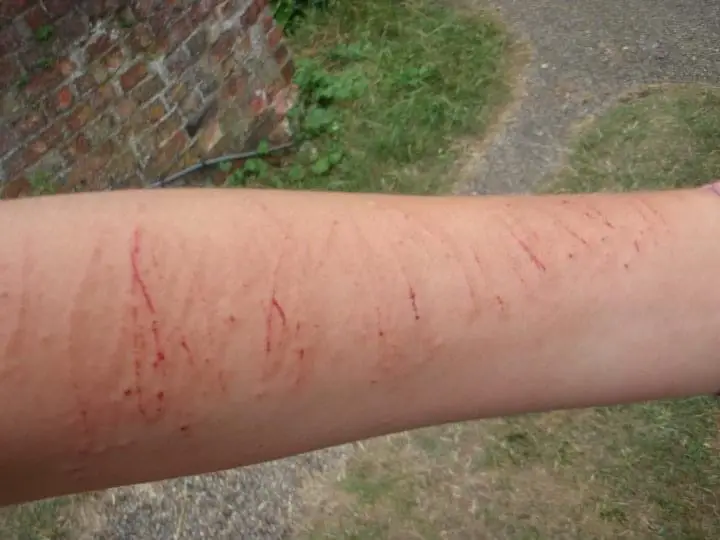 Do not ride bikes while on vacation! They make for a very funny story of you falling In Oxford 