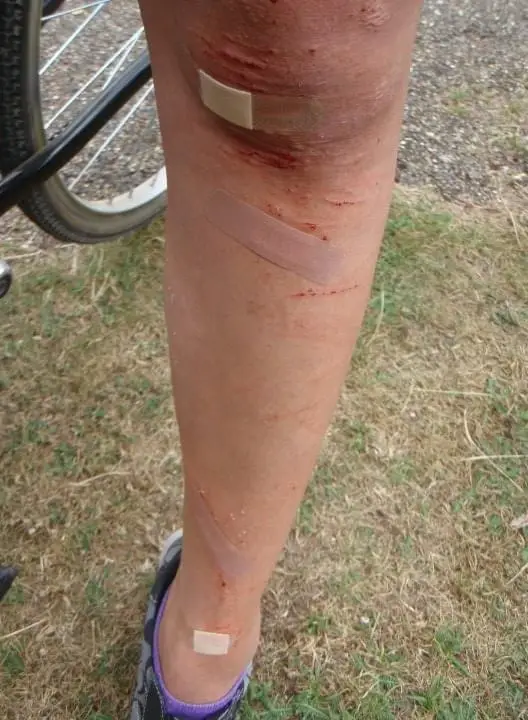 Do not ride bikes while on vacation! They make for a very funny story of you falling going to Woodstock 